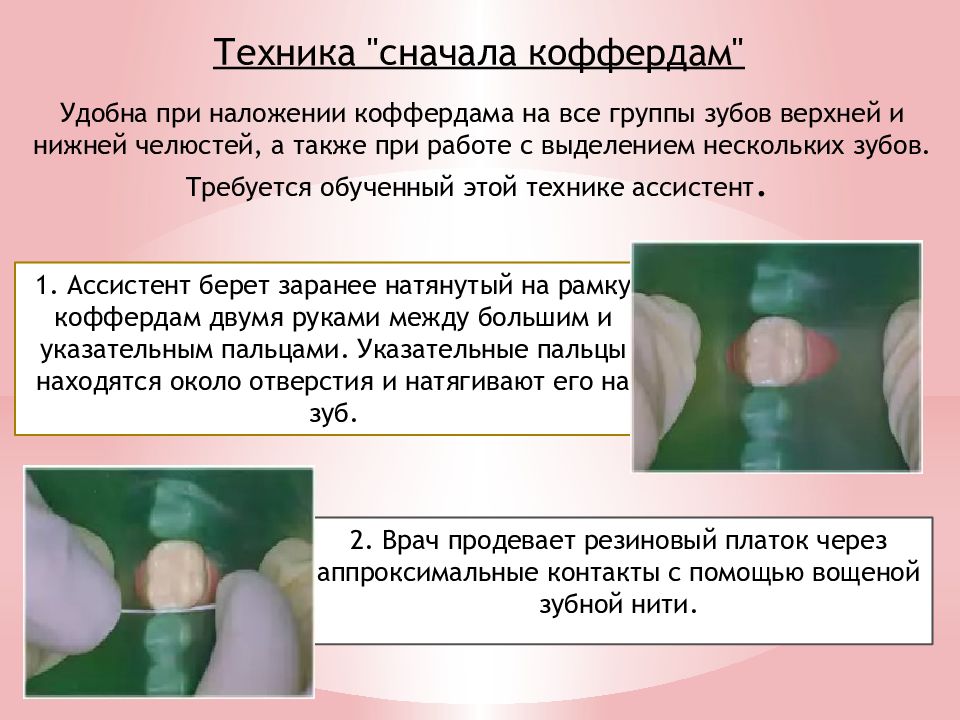 Изоляция рабочего поля матричные системы презентация