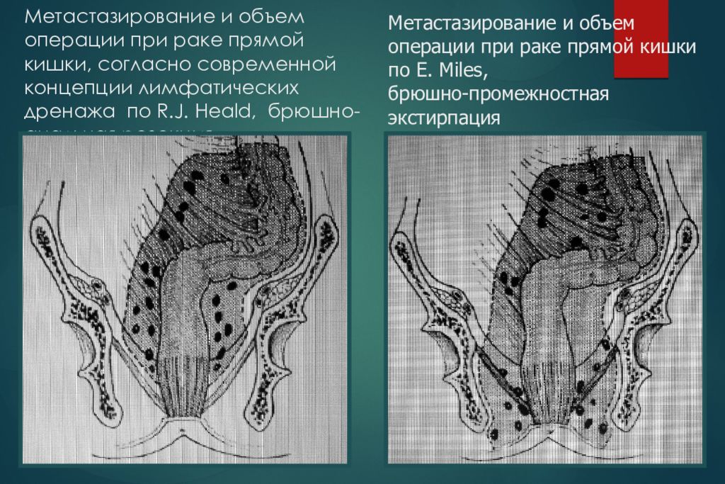 Что значит сосудистый рисунок смазан