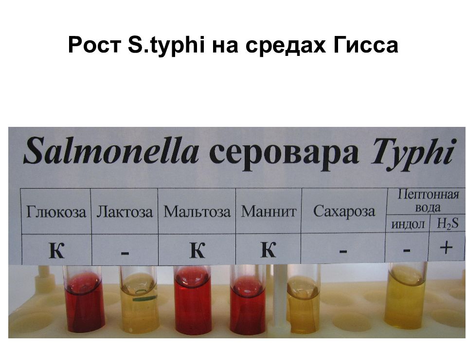 Среда е. Среда Гиса пестрый ряд. Пестрый ряд микробиология. Среда Гисса микробиология.