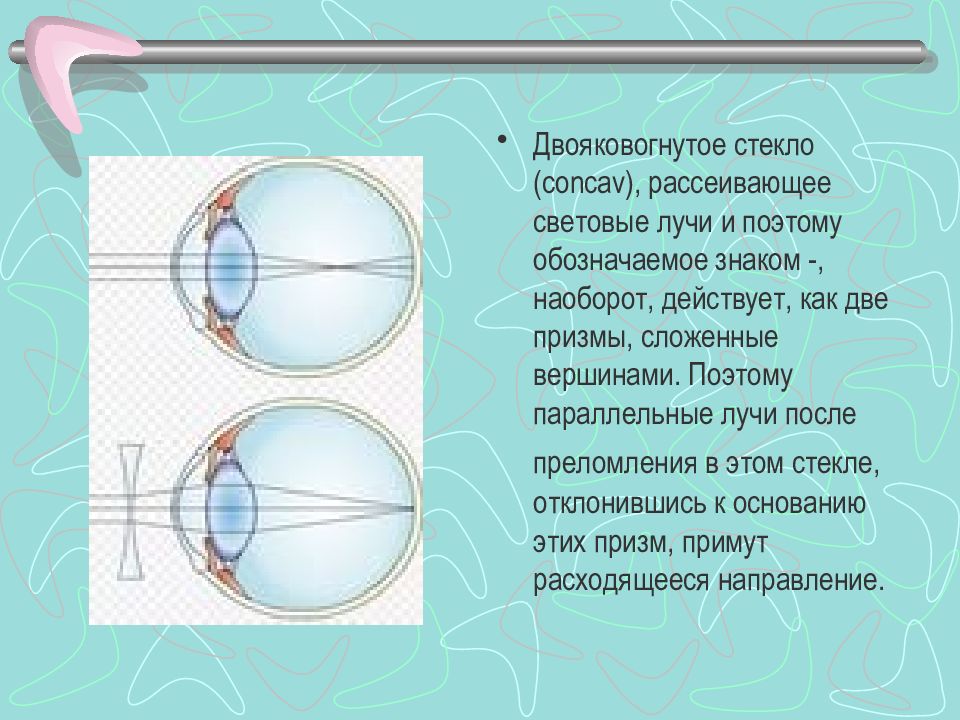 Рефракция глаза презентация