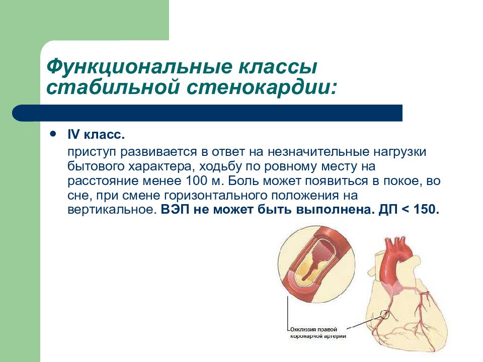 ИБС стабильная стенокардия. Стабильная стенокардия функциональные классы. ИБС стенокардия напряжения функциональные классы. Стабильная стенокардия характер боли.