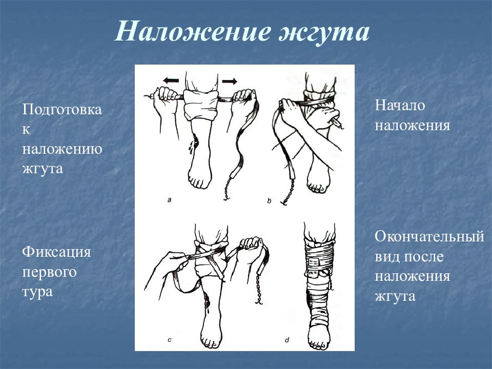 Наложение жгута животному.