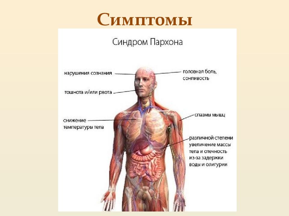 Синдром пархона презентация