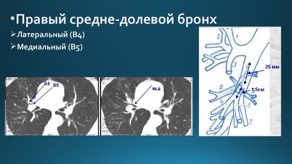 Лучевая диагностика органов дыхания презентация