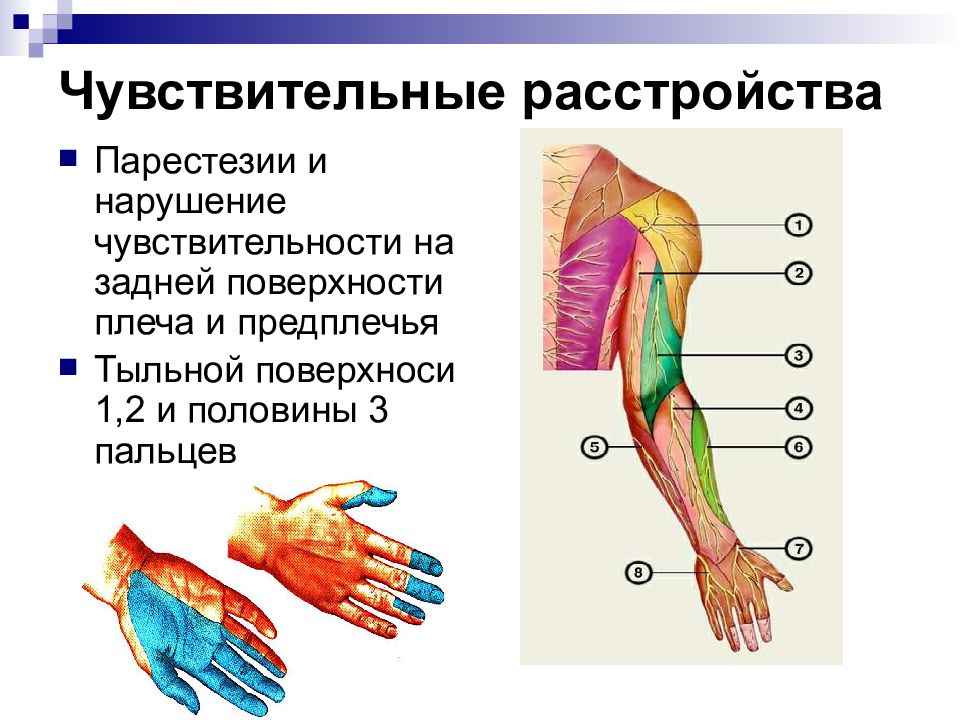 Поражение периферических нервов лучевого локтевого срединного клиническая картина