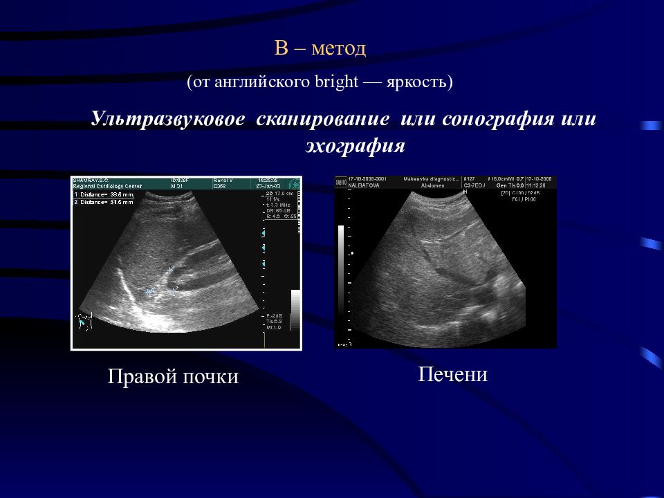 Сонография это. Сонография. Сонография печени. Сонография почек.