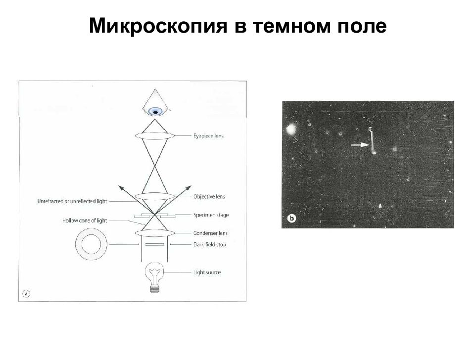 Поле микроскопа. Темнопольная микроскопия схема. Метод темного поля в микроскопии. Схема темнопольного микроскопа. Метод темного поля в микроскопии физика.