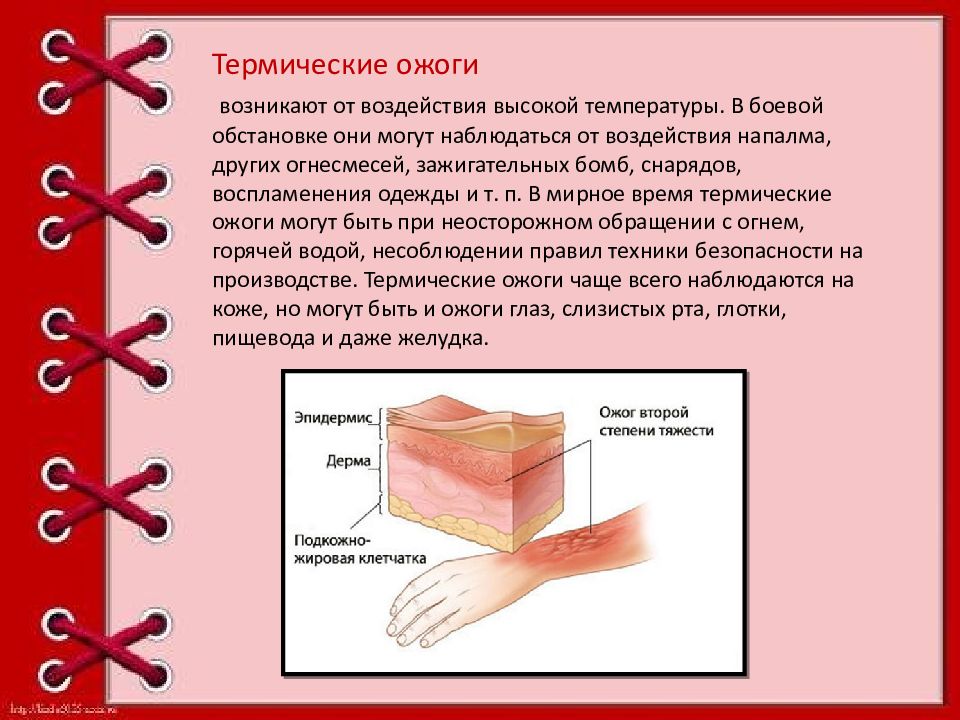 Презентация химические ожоги первая помощь