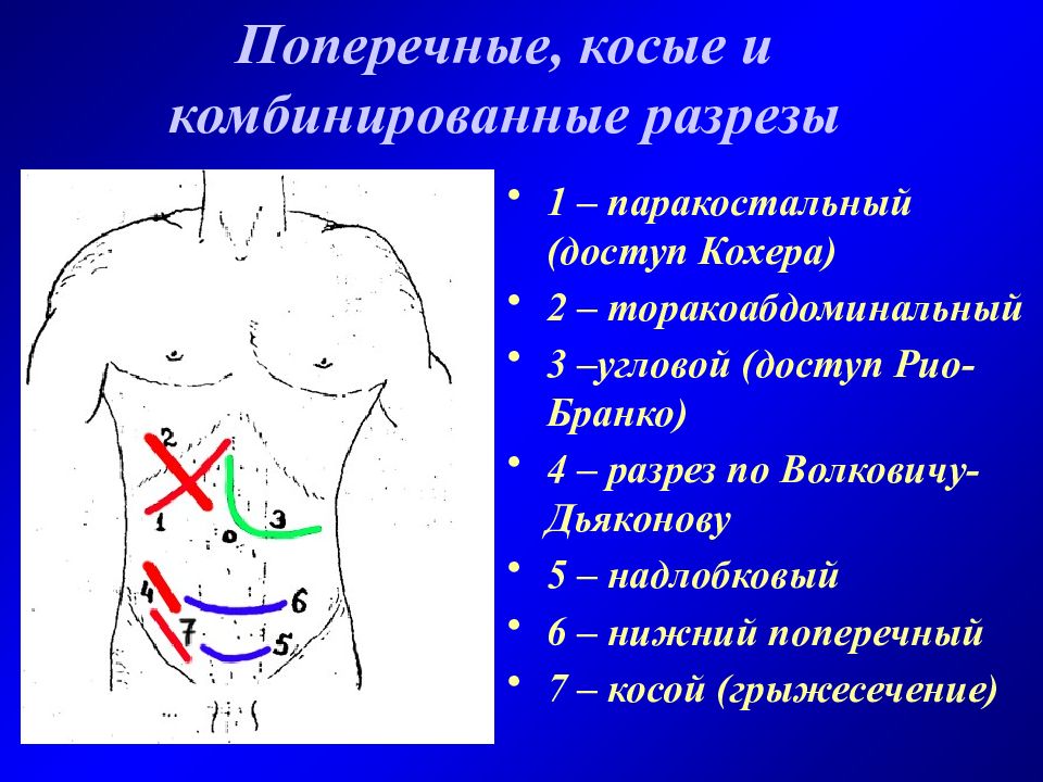 Мак бурнея