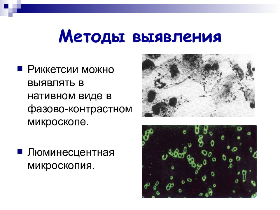 Rickettsia prowazekii. Рикеетсии провчека микроскопия. Риккетсия Провачека сыпной тиф. Риккетсия Провачека микроскоп. Риккетсия Провачека морфология.