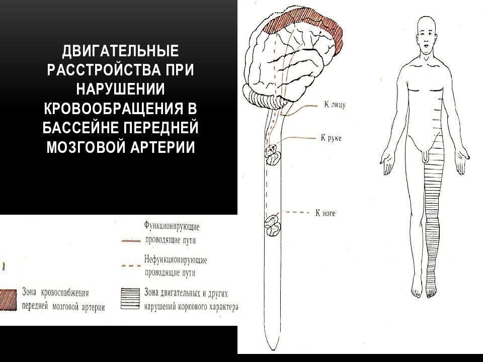 Двигательные нарушения. Синдром передней спинальной артерии. Синдром поражения передней спинальной артерии. Синдромы поражения передней мозговой артерии. Синдром передней спинномозговой артерии.