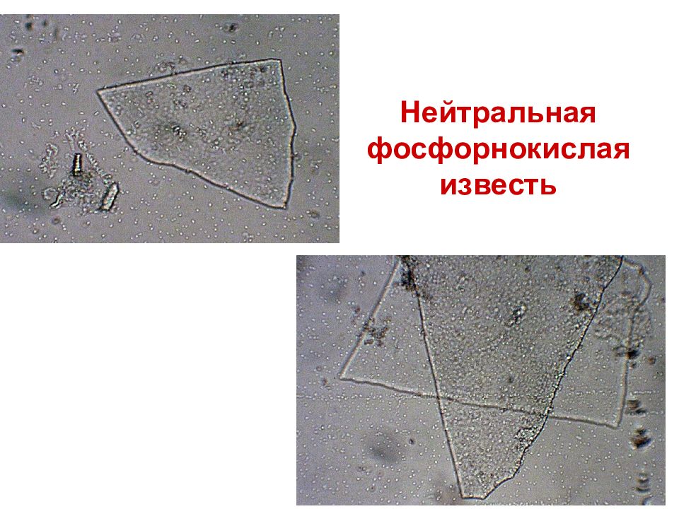 Микроскопия осадка мочи фото с описанием