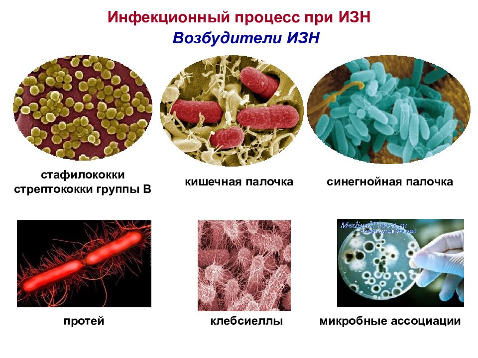 Инфекционный процесс. Возбудители инфекционного процесса. Септический процесс. Инфекционные заболевания новорожденных презентация.