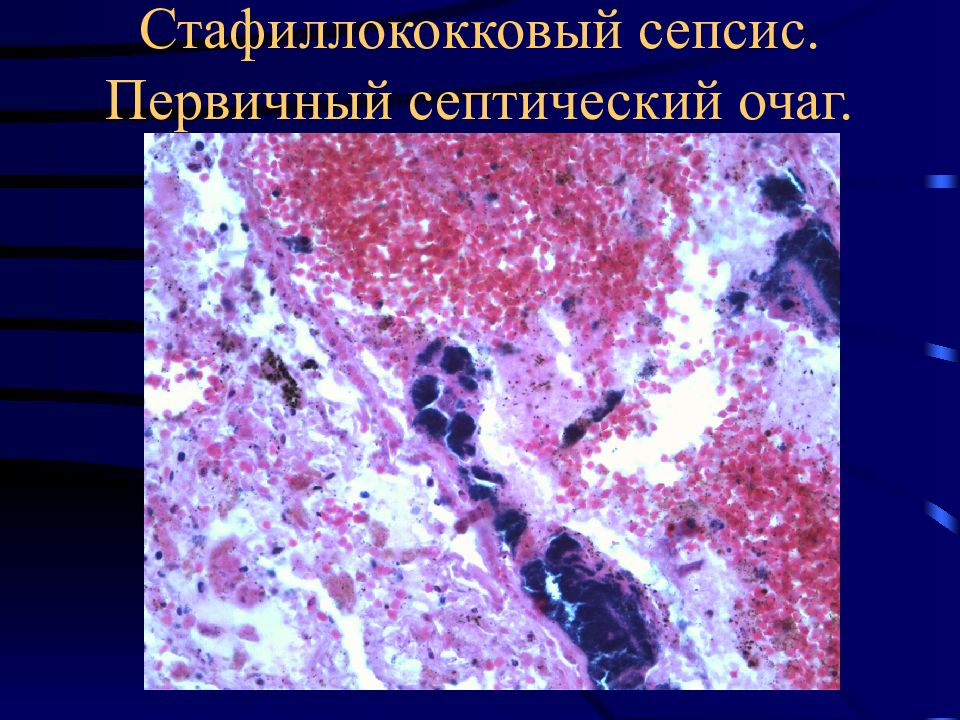 Инфекционные болезни патанатомия презентация