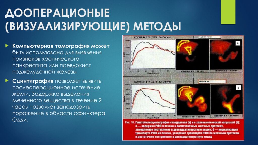 ДООПЕРАЦИОНЫЕ (ВИЗУАЛИЗИРУЮЩИЕ) МЕТОДЫ