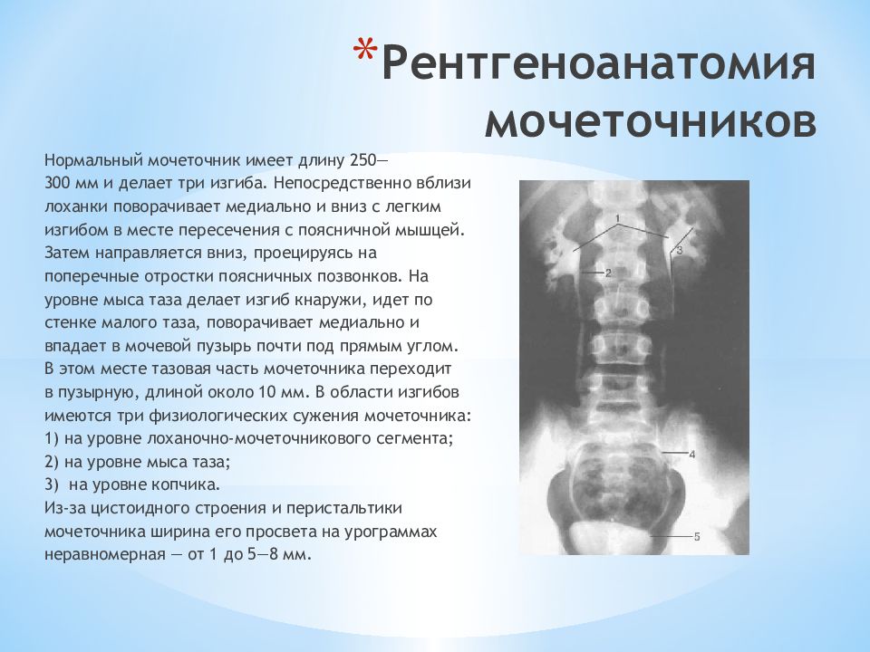 Лучевая диагностика почек презентация