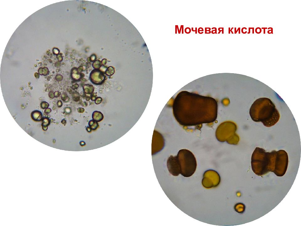 Фото мочекислый аммоний