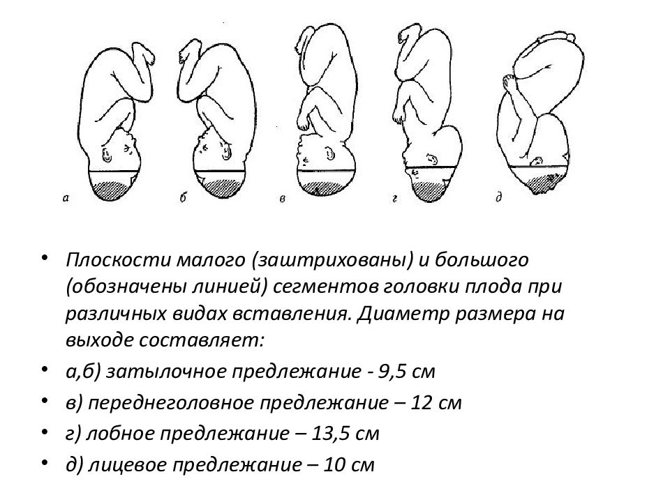 Презентация головка плода