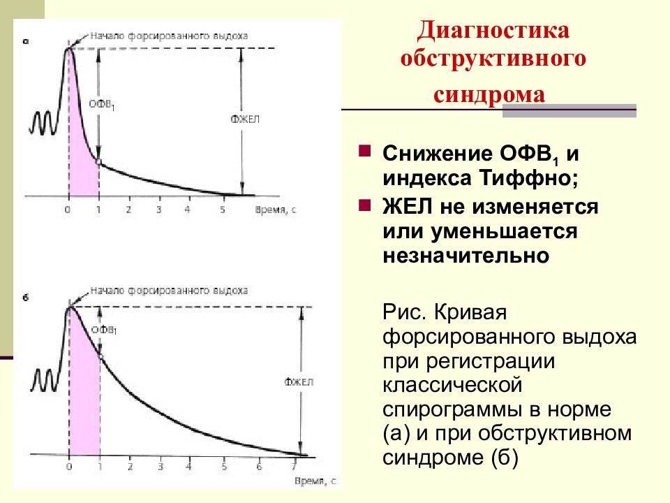 Снижение офв1. Спирограмма обструктивный Тип. Исследование форсированного выдоха. Кривая форсированного выдоха. Снижение ФЖЕЛ И офв1.