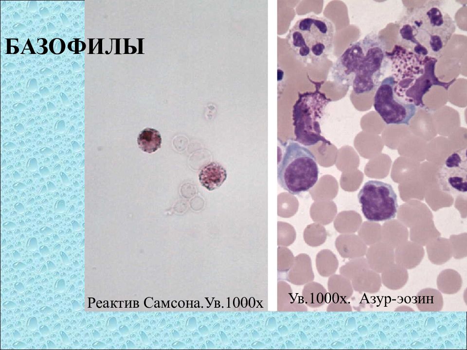 реактив самсона. реактив самсона. лимфоциты в реактиве самсона. реактив самсона. наборы реагентов эколаб.