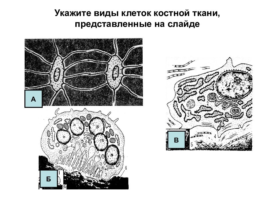 Клетки костной ткани. Тип клетки скелетной ткани\. Схема строения костной клетки. Клетки костной ткани схема. Костные клетки в костной ткани.