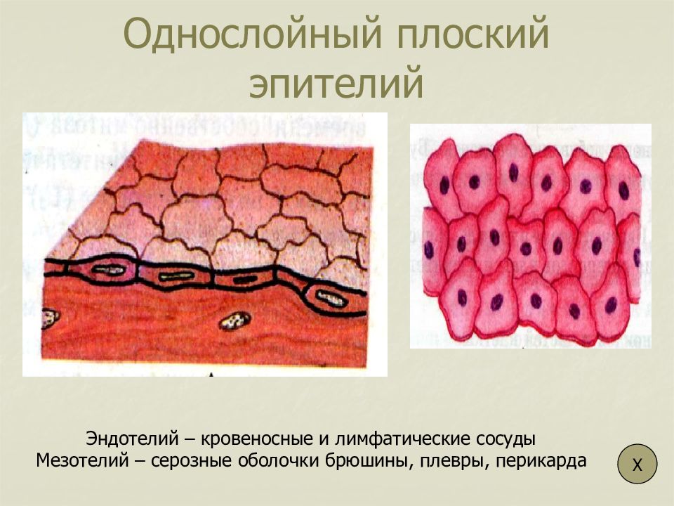 Однослойный плоский эпителий выстилает. Опухоли из эндотелия и мезотелия.