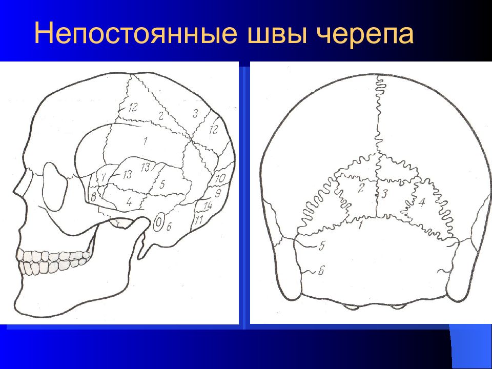 Швы черепа. Сагиттальный шов черепа. Расхождение швов черепа. Непостоянные швы черепа.