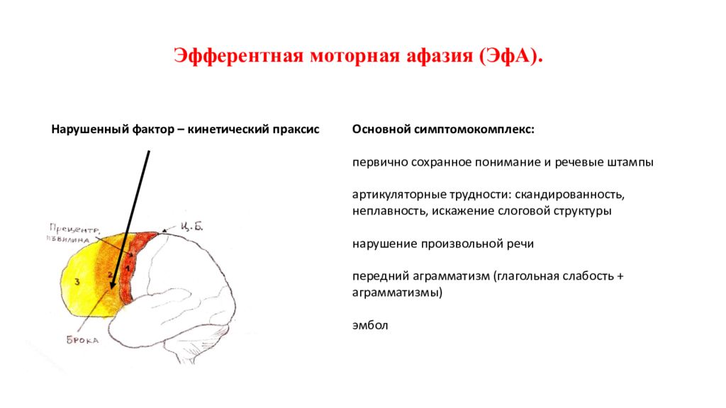 Афферентная афазия. Эфферентная моторная афазия. Эфферентная моторная афазия локализация. Локализацию поражения при эфферентной афазии?. Моторная афазия эфферентного типа.