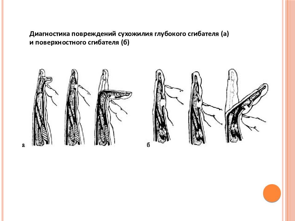 Повреждения плечевого пояса презентация