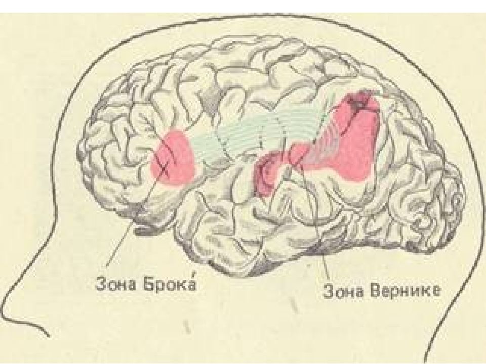 Зона брока и вернике. Речевые зоны коры головного мозга Брока. Мозг центр Брока и Вернике. Речевые центры. Зона Брока. Зона Вернике.