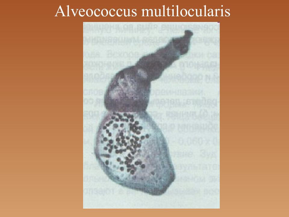 Альвеококк. Альвеококк (alveococcus multilocularis). Alveococcus multilocularis строение финны. Финна альвеококка строение.