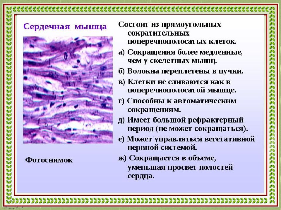 Сокращение клеток. Сокращение клетки. Клетки сокращающие сердце. Сокращена клеточного. Клетки сокращают.