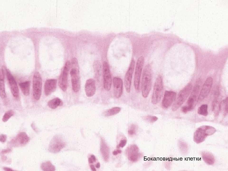 Бокаловидные клетки. Бокаловидные клетки эпителия кишечника. Бокаловидные железистые клетки. Бокаловидная клетка гистология. Бокаловидные клетки эпителия тонкой кишки.