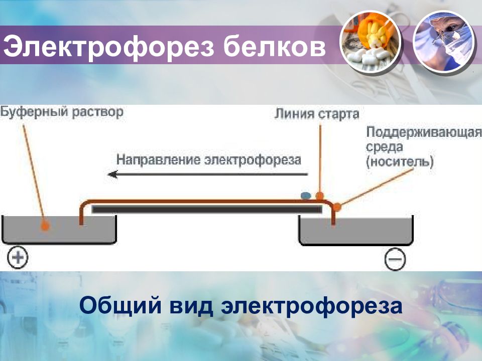 Электрофорез белков