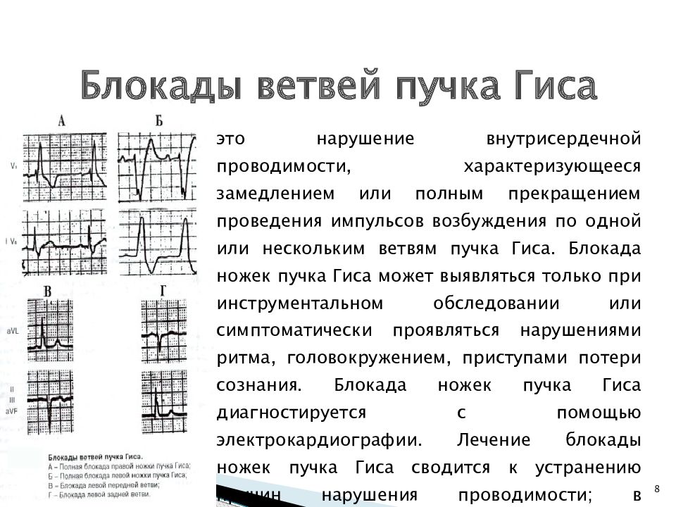 Блокада передней ветви левой ножки. Блокада левой ножки пучка Гиса (нарушение проводимости) ЭКГ. Неполная блокада передней ветви правой ножки Гиса. Блокада передней ветви правой ножки пучка Гиса. Замедление проводимости ПНПГ.