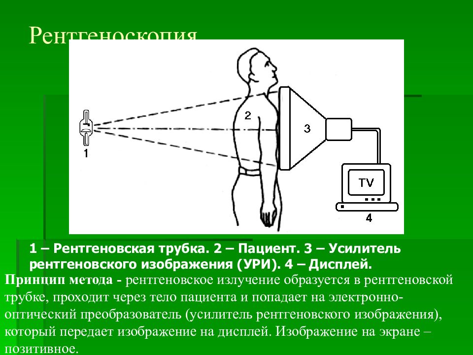 Усилитель рентгеновского изображения