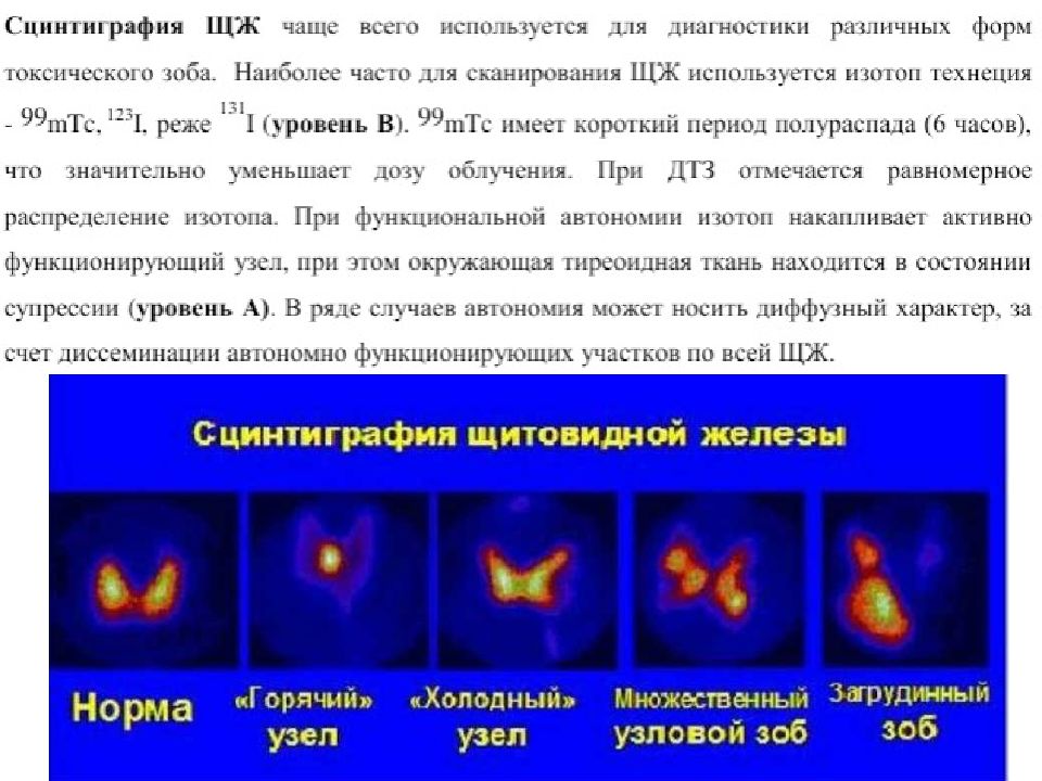 Что значит сосудистый рисунок усилен в щитовидной железе