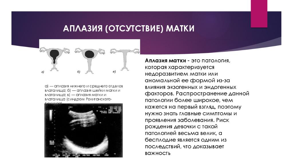 Глубина матки. Аплазия матки и влагалища.