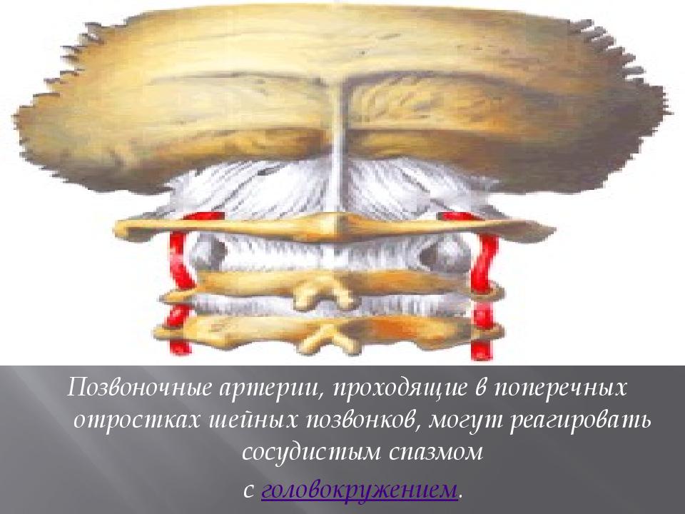 Позвоночные артерии картинки