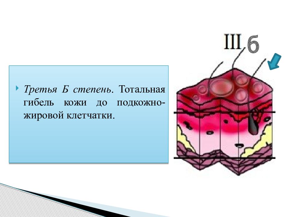 Третья б