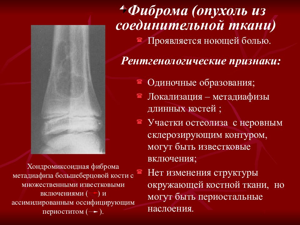 Метастатическое поражение костей. Рентгенодиагностика заболеваний суставов. Заболевание костей и суставов. Остеолитическое поражение костей. Рентгенодиагностика заболеваний костей и суставов.