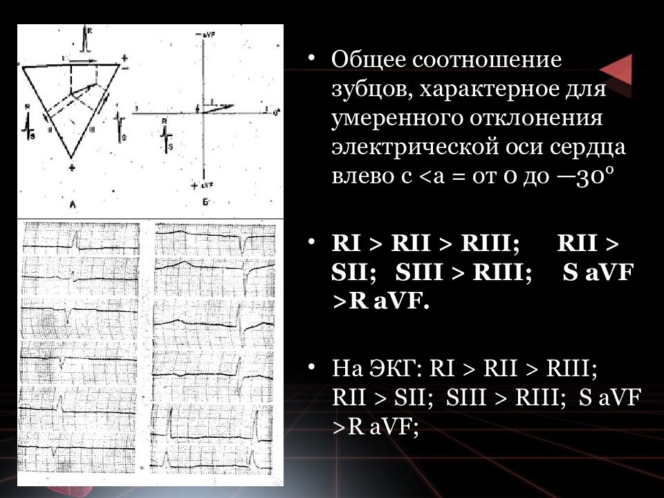 Отклонение эос влево