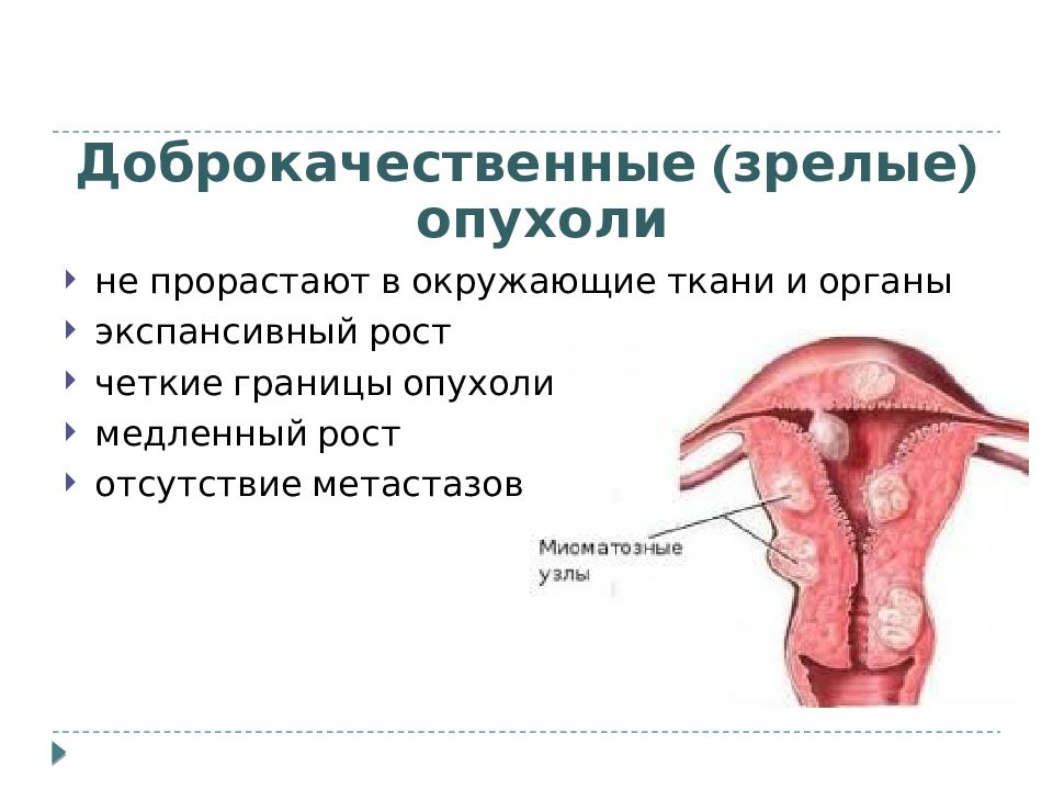 Доброкачественные опухоли презентация