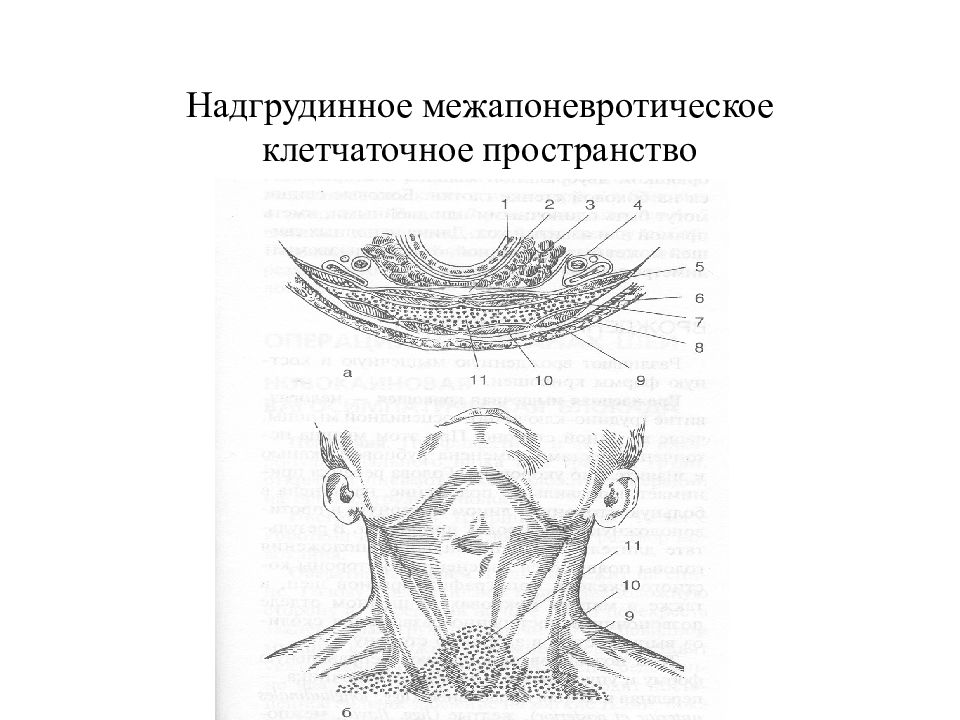 Топографическая анатомия и оперативная хирургия шеи презентация