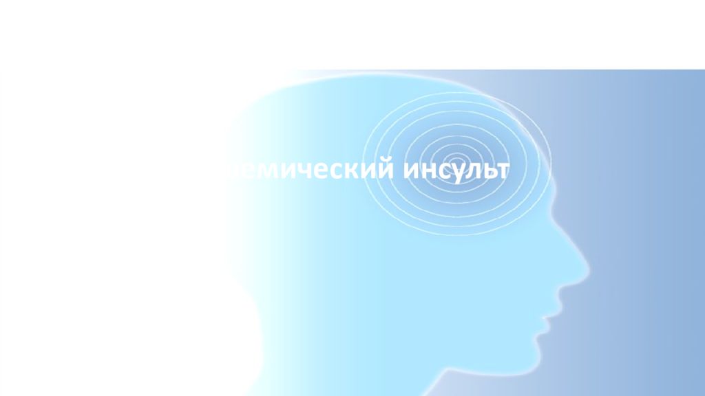 Ишемический инсульт