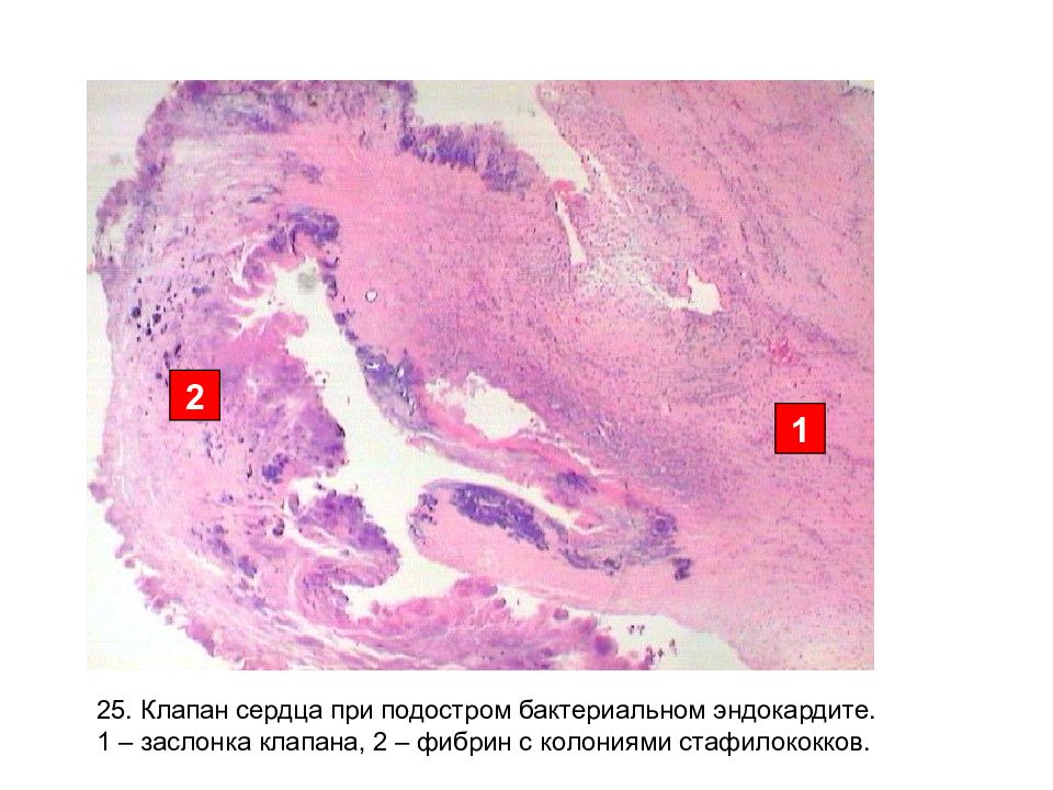 Митральный клапан гистология рисунок