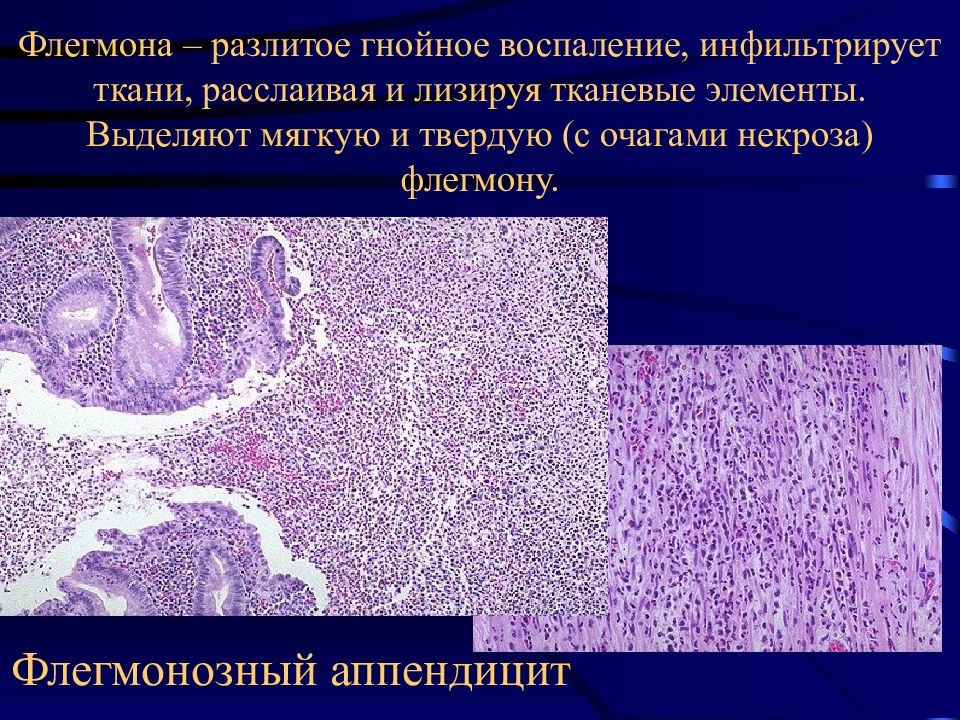 Воспаление патанатомия презентация