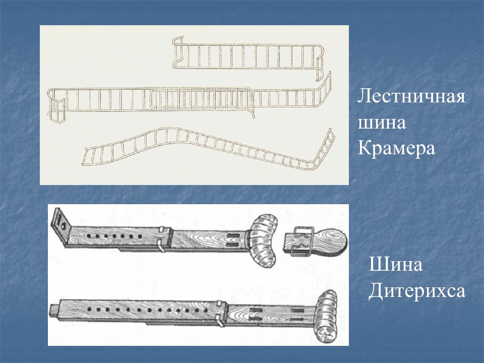 Шина краммера. Иммобилизация шиной Крамера. Шина Дитерихса и шина Крамера. Иммобилизация шиной Дитерихса. Лестничные шины (шины Крамера),.