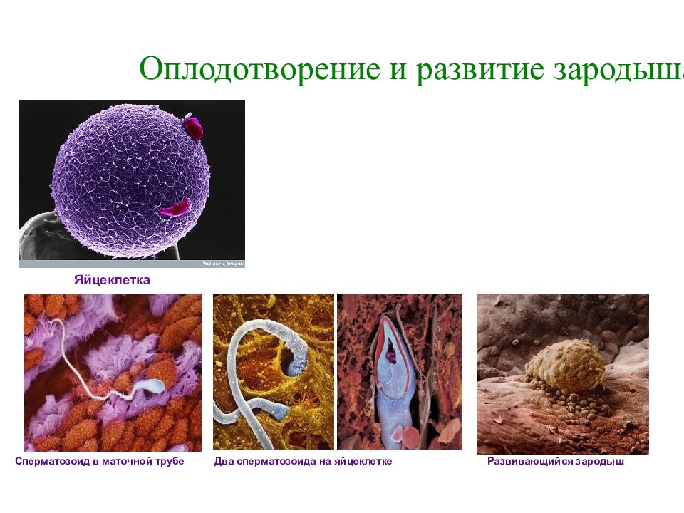 Органы оплодотворения. Оплодотворение и развитие зародыша. Оплодотворение двумя спермиями. Яйцеклетка и 2 сперматозоида. Два сперматозоида в ооците.