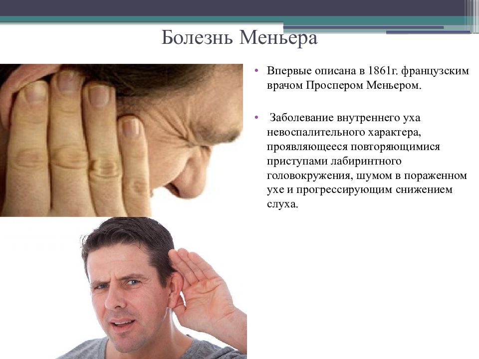 Нарушение внутреннего уха. Болезнь Меньера внутреннее ухо. Синдром внутреннего уха. Синдром Меньера.